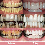 Whitening Toothpaste Removal Plaque Stain